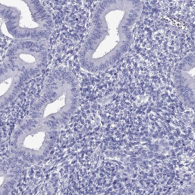TTLL13 Antibody - BSA Free Immunohistochemistry-Paraffin: TTLL13 Antibody [NBP2-13492]