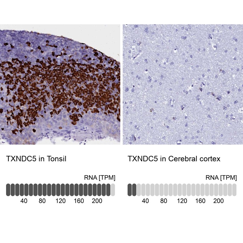 TXNDC5 Antibody - BSA Free Immunohistochemistry-Paraffin: TXNDC5 Antibody [NBP2-13496]