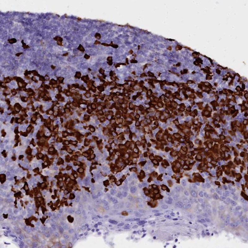 TXNDC5 Antibody - BSA Free Immunohistochemistry-Paraffin: TXNDC5 Antibody [NBP2-13496]