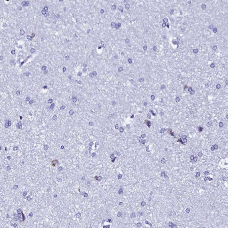 TXNDC5 Antibody - BSA Free Immunohistochemistry-Paraffin: TXNDC5 Antibody [NBP2-13496]