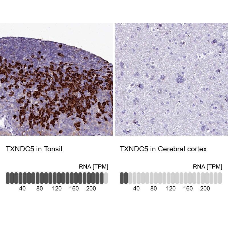 TXNDC5 Antibody - BSA Free Immunohistochemistry-Paraffin: TXNDC5 Antibody [NBP2-13497]