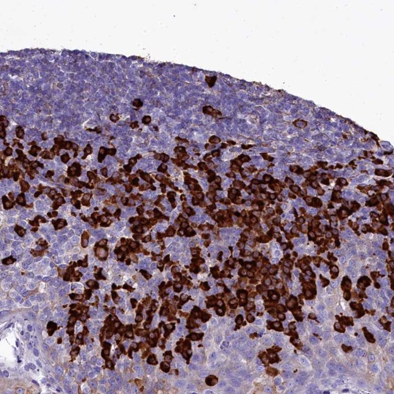TXNDC5 Antibody - BSA Free Immunohistochemistry-Paraffin: TXNDC5 Antibody [NBP2-13497]