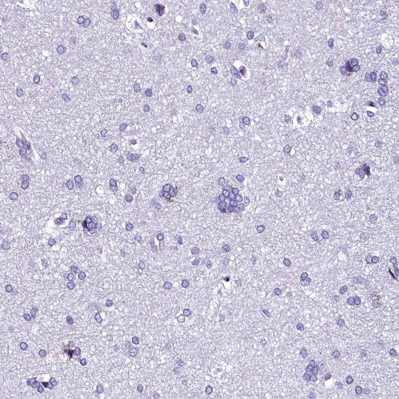 TXNDC5 Antibody - BSA Free Immunohistochemistry-Paraffin: TXNDC5 Antibody [NBP2-13497]
