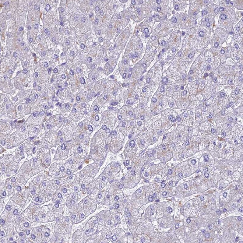 UBE2G1 Antibody - BSA Free Immunohistochemistry: UBE2G1 Antibody - BSA Free [NBP2-13499]