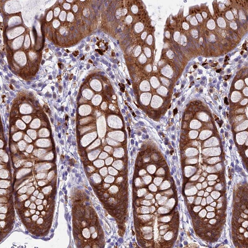 UBE2G1 Antibody - BSA Free Immunohistochemistry: UBE2G1 Antibody - BSA Free [NBP2-13499]