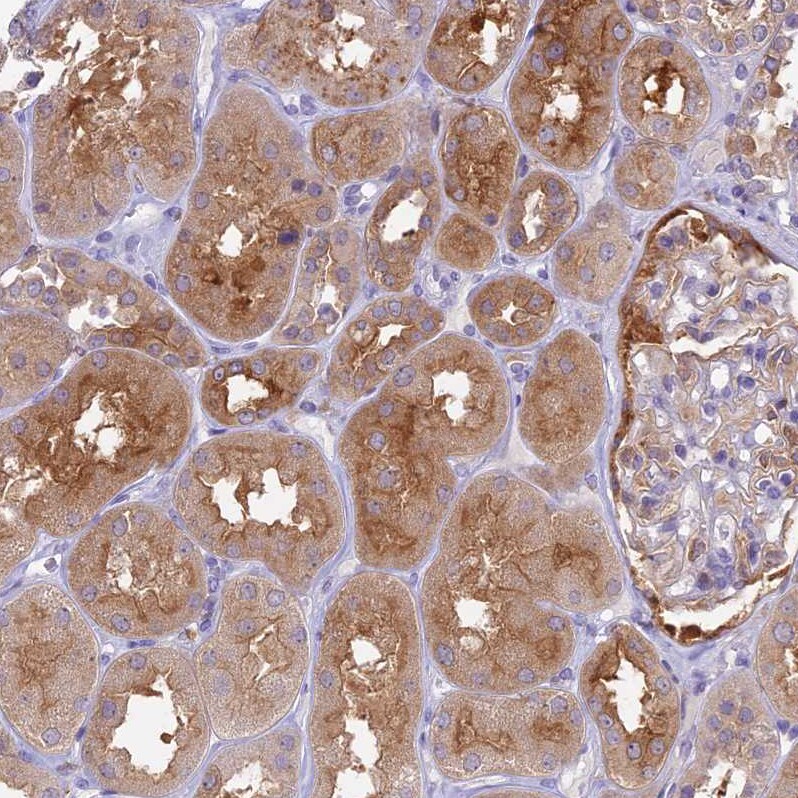 UBE2G1 Antibody - BSA Free Immunohistochemistry: UBE2G1 Antibody - BSA Free [NBP2-13499]