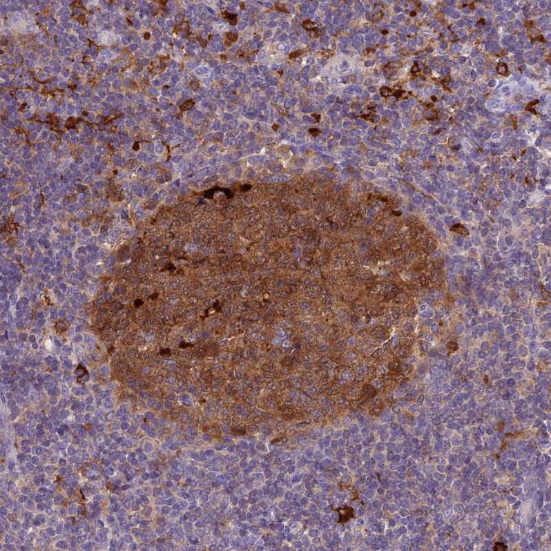 UBE2G1 Antibody - BSA Free Immunohistochemistry: UBE2G1 Antibody - BSA Free [NBP2-13499]