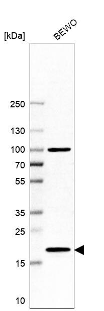 UBE2G1 Antibody - BSA Free Western Blot: UBE2G1 Antibody - BSA Free [NBP2-13499]