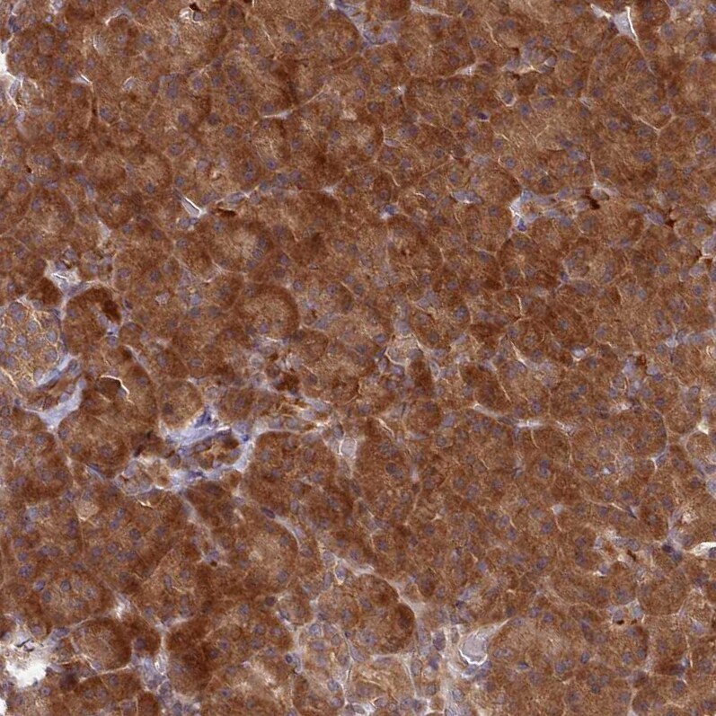UBE2G1 Antibody - BSA Free Immunohistochemistry: UBE2G1 Antibody - BSA Free [NBP2-13500]
