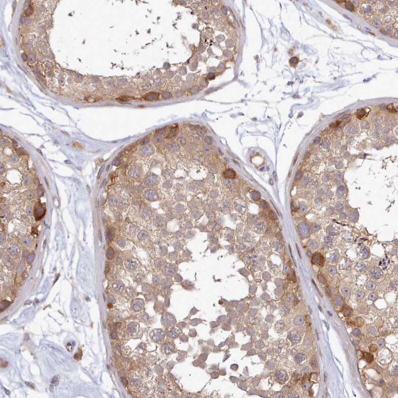 UBE2G1 Antibody - BSA Free Immunohistochemistry: UBE2G1 Antibody - BSA Free [NBP2-13500]