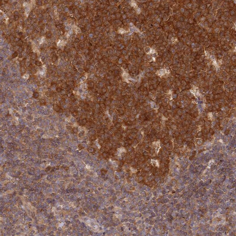 UBE2G1 Antibody - BSA Free Immunohistochemistry: UBE2G1 Antibody - BSA Free [NBP2-13500]