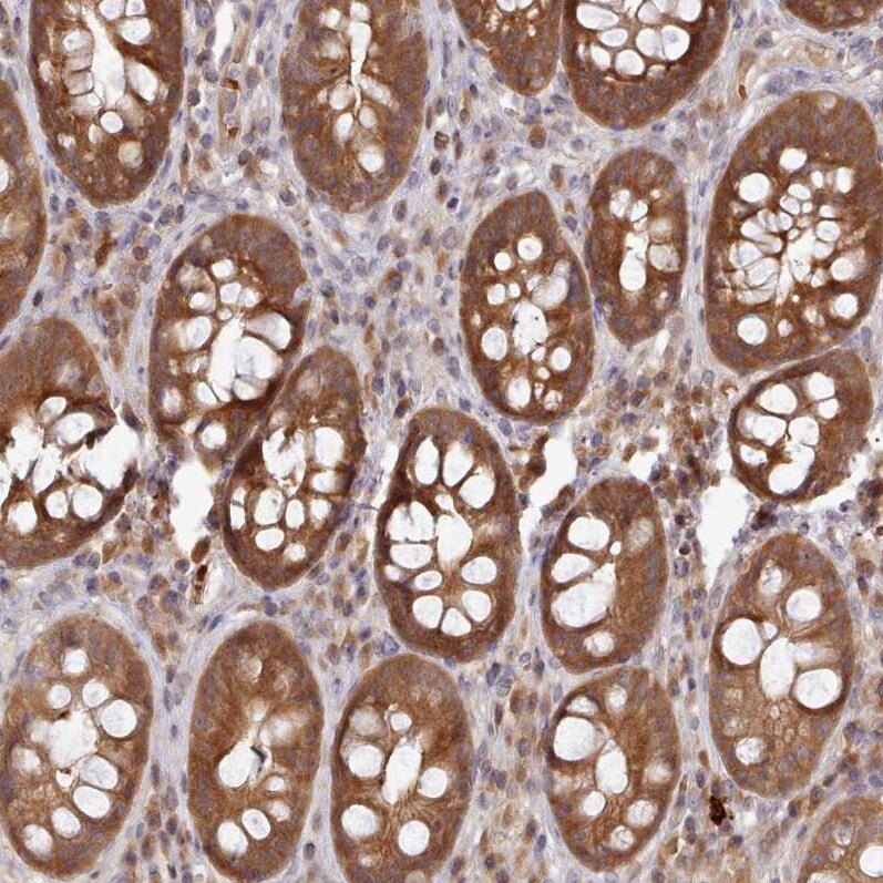 UBE2G1 Antibody - BSA Free Immunohistochemistry: UBE2G1 Antibody - BSA Free [NBP2-13500]