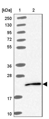 UBE2G1 Antibody - BSA Free Western Blot: UBE2G1 Antibody - BSA Free [NBP2-13500]