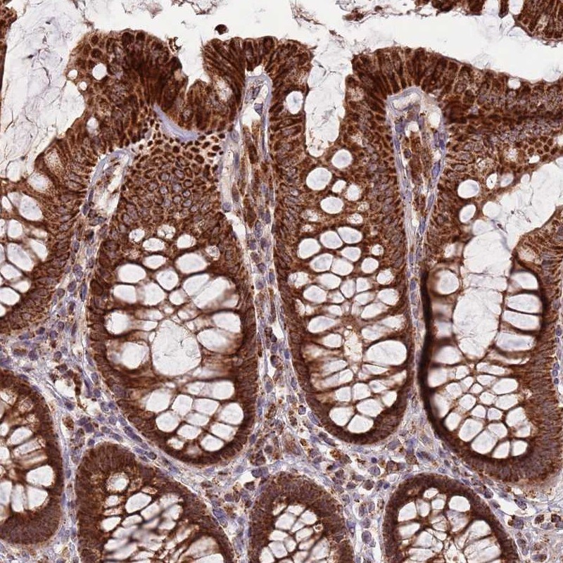 ULK3 Antibody - BSA Free Immunohistochemistry-Paraffin: ULK3 Antibody [NBP2-13505]