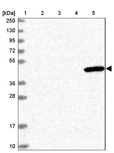 ULK3 Antibody - BSA Free Western Blot: ULK3 Antibody - BSA Free [NBP2-13505]