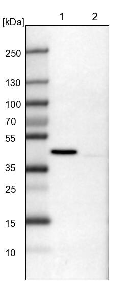 ULK3 Antibody - BSA Free Western Blot: ULK3 Antibody - BSA Free [NBP2-13505]