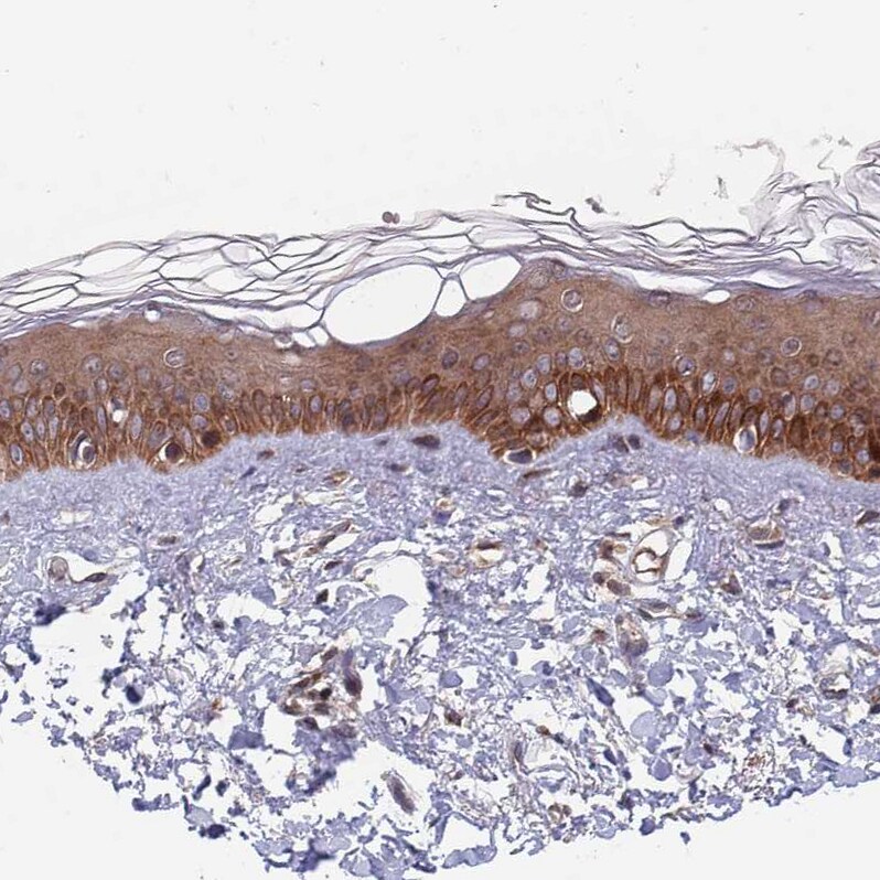 UNC45A Antibody - BSA Free Immunohistochemistry: UNC45A Antibody - BSA Free [NBP2-13506]
