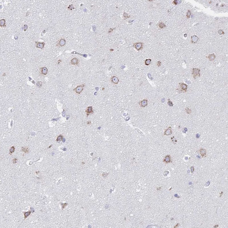 VKORC1L1 Antibody - BSA Free Immunohistochemistry: VKORC1L1 Antibody - BSA Free [NBP2-13516]
