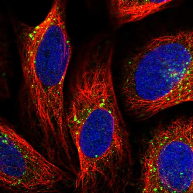 VPS35 Antibody - BSA Free Immunocytochemistry/ Immunofluorescence: VPS35 Antibody [NBP2-13517]