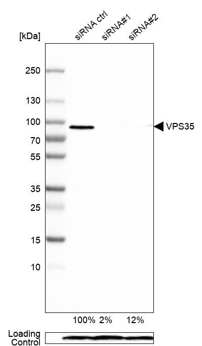 VPS35 Antibody - BSA Free Western Blot: VPS35 Antibody - BSA Free [NBP2-13517]