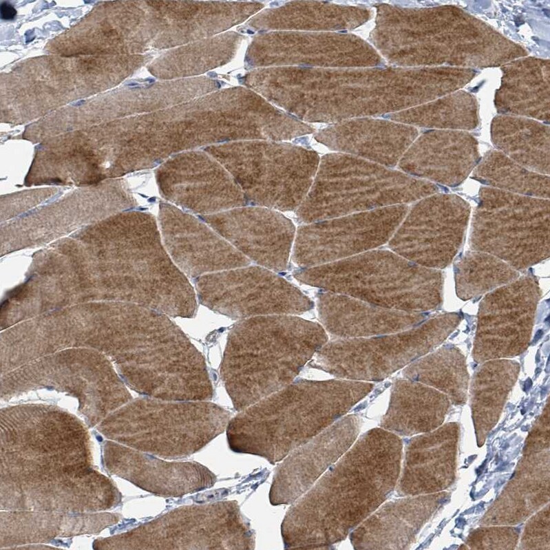 FENS1 Antibody - BSA Free Immunohistochemistry: FENS1 Antibody - BSA Free [NBP2-13521]