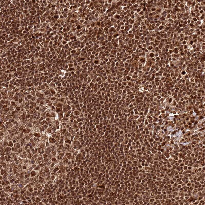 XRN2 Antibody - BSA Free Immunohistochemistry: XRN2 Antibody - BSA Free [NBP2-13529]