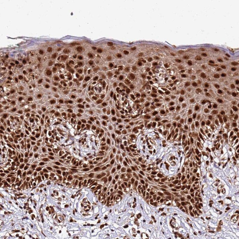 XRN2 Antibody - BSA Free Immunohistochemistry: XRN2 Antibody - BSA Free [NBP2-13529]