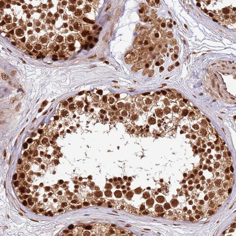 XRN2 Antibody - BSA Free Immunohistochemistry: XRN2 Antibody - BSA Free [NBP2-13529]