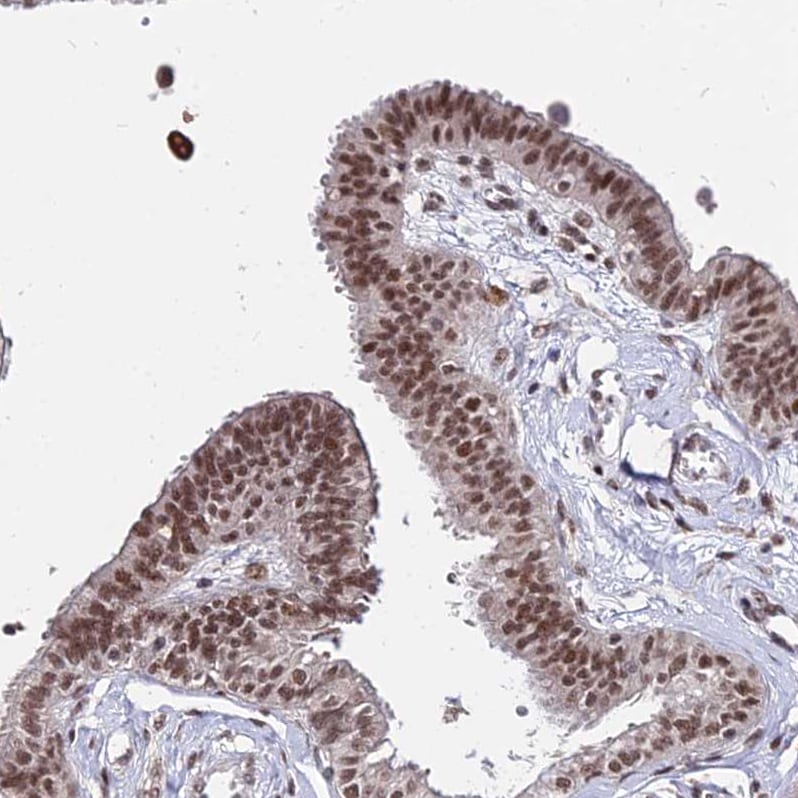 ZBED4 Antibody - BSA Free Immunohistochemistry: ZBED4 Antibody - BSA Free [NBP2-13531]