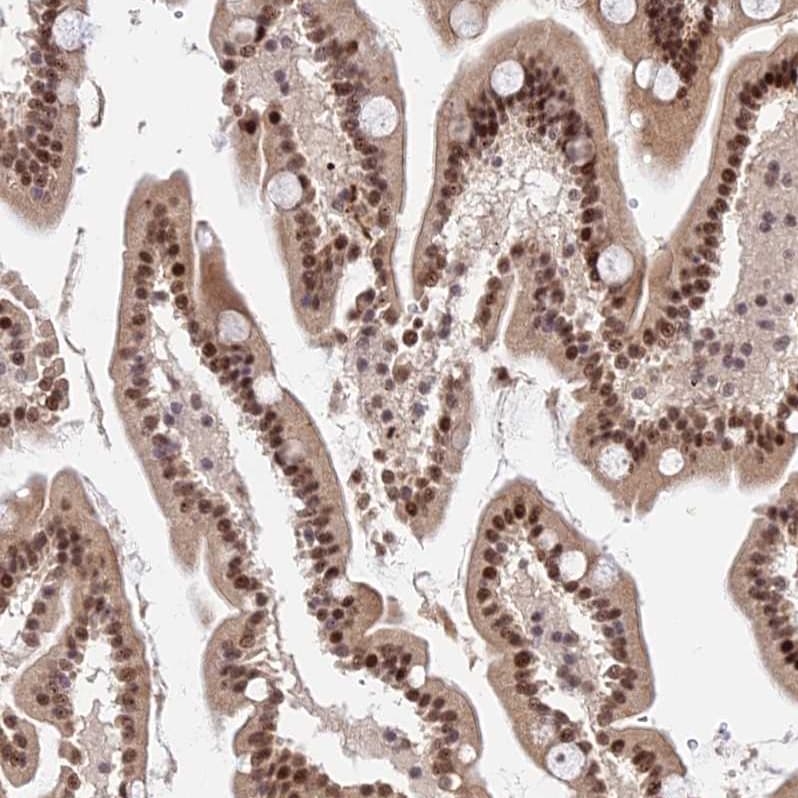 ZBED4 Antibody - BSA Free Immunohistochemistry: ZBED4 Antibody - BSA Free [NBP2-13531]