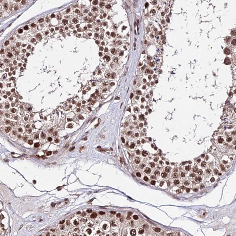 ZBED4 Antibody - BSA Free Immunohistochemistry: ZBED4 Antibody - BSA Free [NBP2-13531]