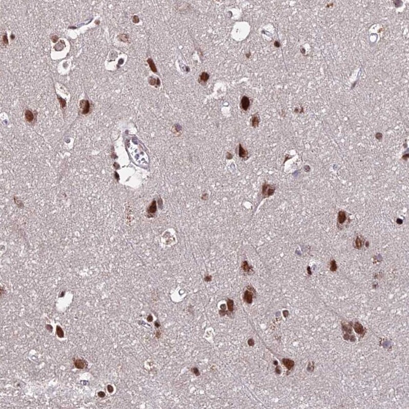 ZBED4 Antibody - BSA Free Immunohistochemistry: ZBED4 Antibody - BSA Free [NBP2-13531]