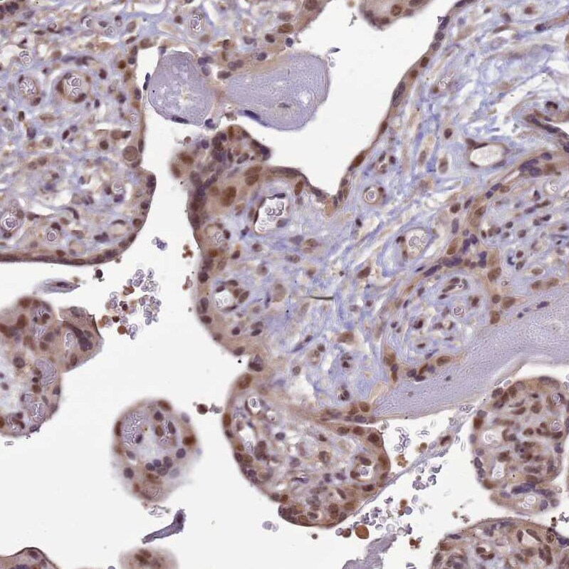 ZBTB5 Antibody - BSA Free Immunohistochemistry: ZBTB5 Antibody - BSA Free [NBP2-13536]