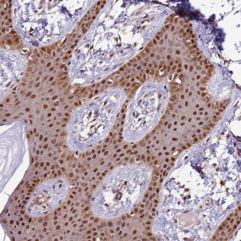 ZBTB5 Antibody - BSA Free Immunohistochemistry: ZBTB5 Antibody - BSA Free [NBP2-13536]
