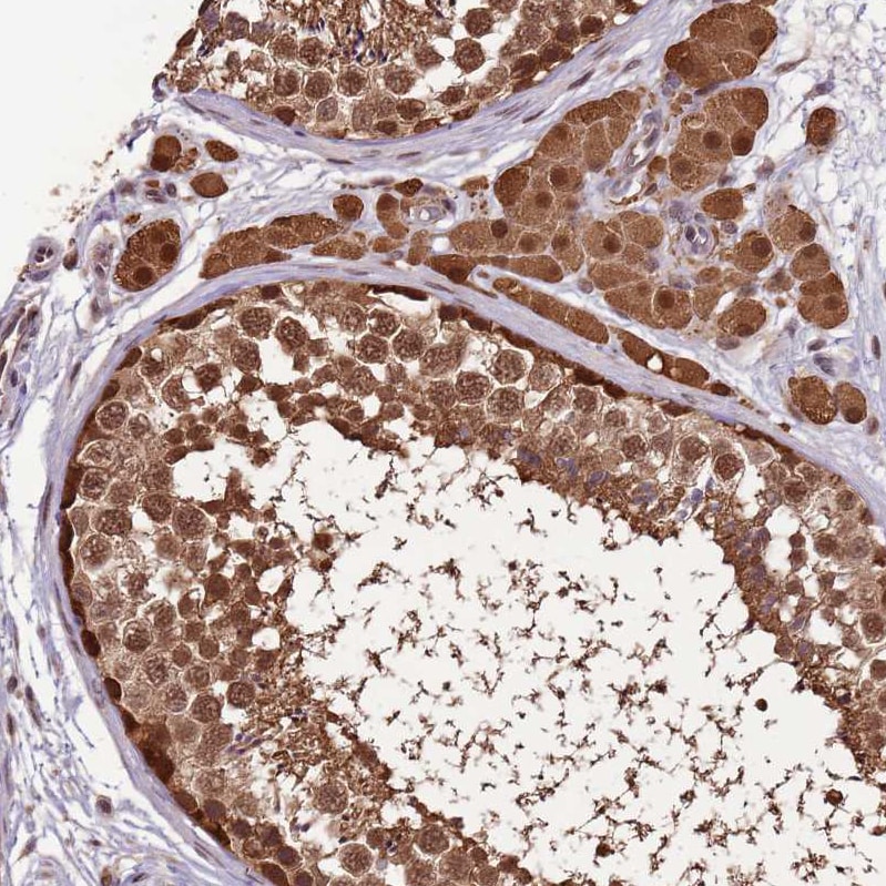 ZBTB5 Antibody - BSA Free Immunohistochemistry: ZBTB5 Antibody - BSA Free [NBP2-13536]