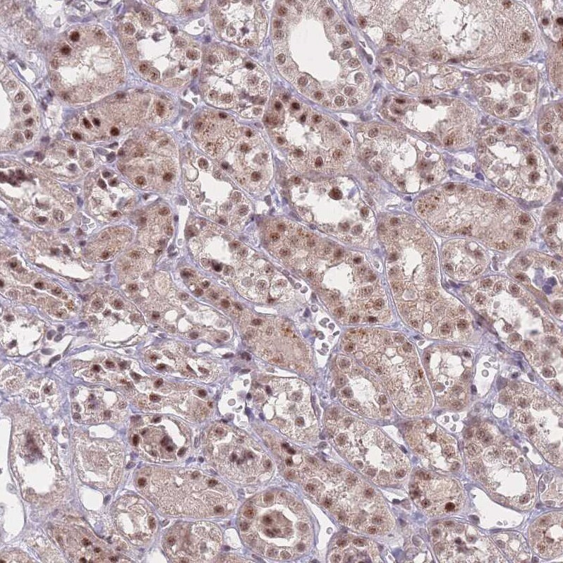 ZC3H14 Antibody - BSA Free Immunohistochemistry: ZC3H14 Antibody - BSA Free [NBP2-13537]