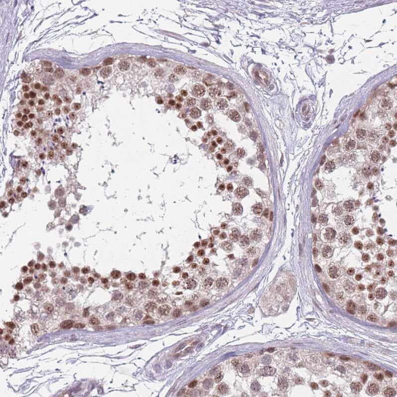ZC3H14 Antibody - BSA Free Immunohistochemistry: ZC3H14 Antibody - BSA Free [NBP2-13537]