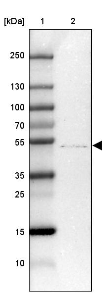 ZDHHC1 Antibody - BSA Free Western Blot: ZDHHC1 Antibody - BSA Free [NBP2-13539]