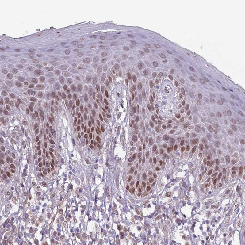 ZGLP1 Antibody - BSA Free Immunohistochemistry: ZGLP1 Antibody - BSA Free [NBP2-13548]