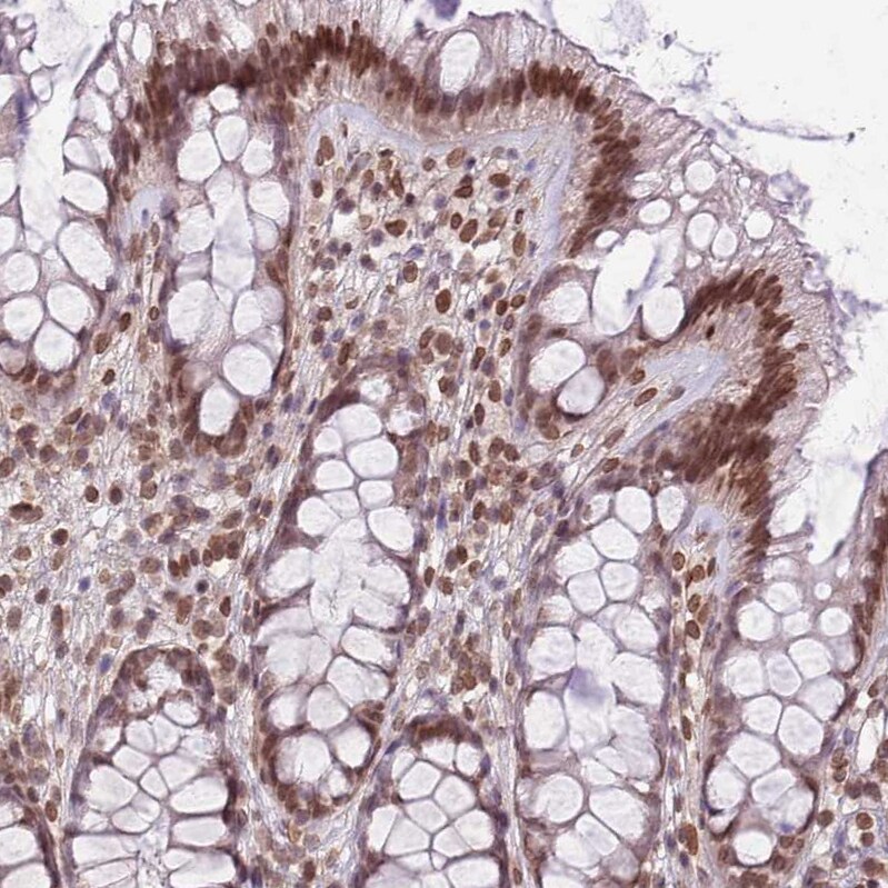 ZGLP1 Antibody - BSA Free Immunohistochemistry: ZGLP1 Antibody - BSA Free [NBP2-13548]