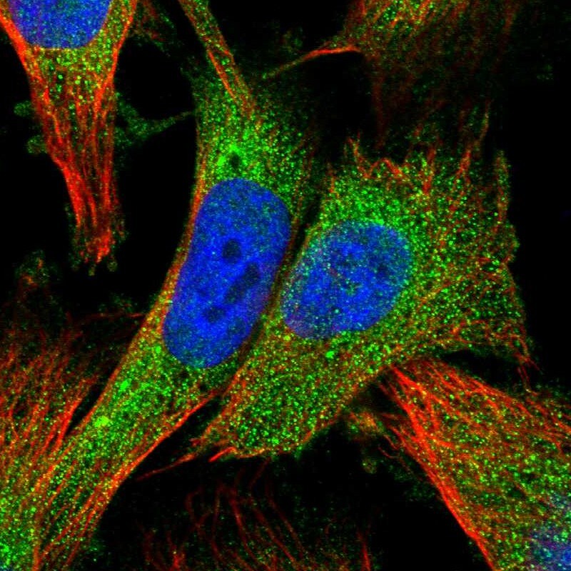 ZNF268 Antibody - BSA Free Immunocytochemistry/ Immunofluorescence: ZNF268 Antibody [NBP2-13562]