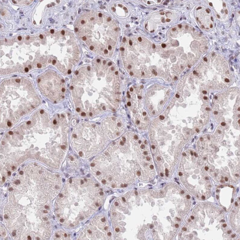 ZNF382 Antibody - BSA Free Immunohistochemistry: ZNF382 Antibody - BSA Free [NBP2-13569]