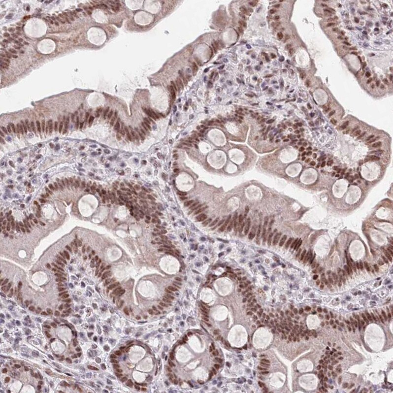 ZNF382 Antibody - BSA Free Immunohistochemistry: ZNF382 Antibody - BSA Free [NBP2-13569]