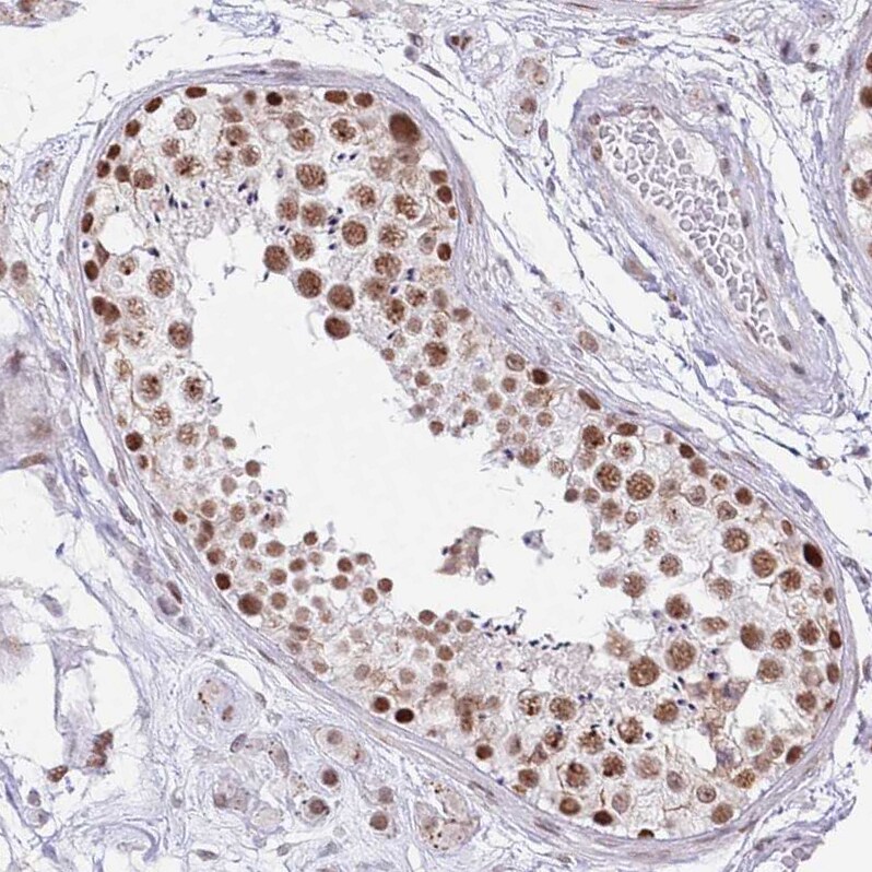 ZNF382 Antibody - BSA Free Immunohistochemistry: ZNF382 Antibody - BSA Free [NBP2-13569]