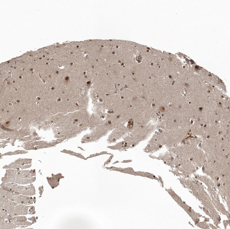 ZNF473 Antibody - BSA Free Immunohistochemistry-Paraffin: ZNF473 Antibody [NBP2-13575]