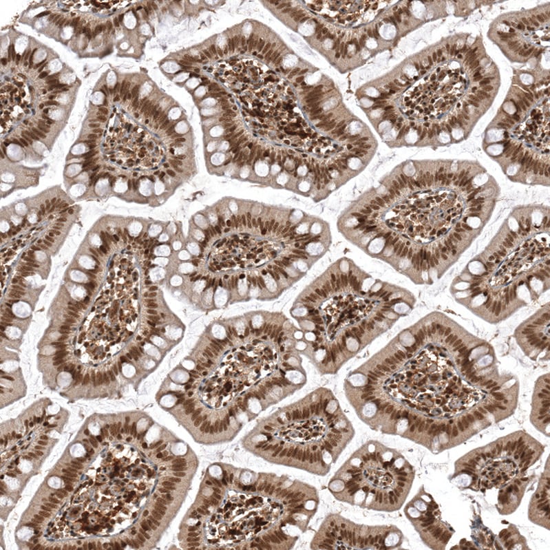 ZNF473 Antibody - BSA Free Immunohistochemistry: ZNF473 Antibody - BSA Free [NBP2-13575]