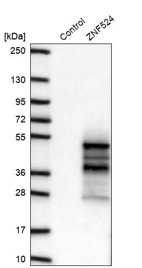 ZNF524 Antibody - BSA Free Western Blot: ZNF524 Antibody - BSA Free [NBP2-13579]