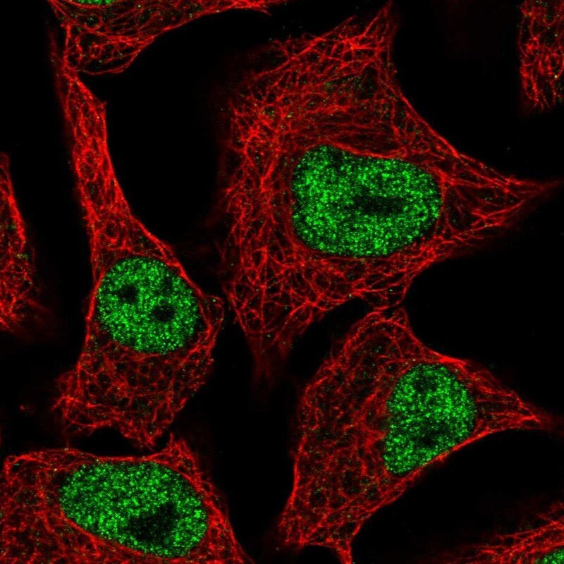 ZNF574 Antibody - BSA Free Immunocytochemistry/ Immunofluorescence: ZNF574 Antibody - BSA Free [NBP2-13582]