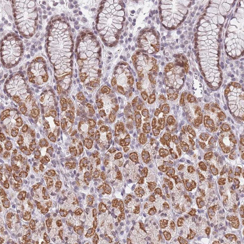ZNF574 Antibody - BSA Free Immunohistochemistry: ZNF574 Antibody - BSA Free [NBP2-13582]