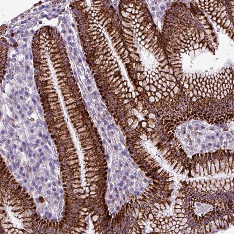 ZNF667 Antibody - BSA Free Immunohistochemistry: ZNF667 Antibody - BSA Free [NBP2-13591]